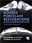 Bonded Porcelain Restorations in the Anterior Dentition: A Biomimetic Approach