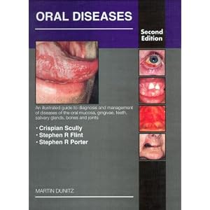 Click here to buy Oral Diseases: An Illustrated Guide to the Diagnosis and Management of Diseases of... by Crispian Scully CBE MD PhD MDS MRCS FDSRCPS FFDRCSI FDSRCS FDSRCSE FRCPath FMedSci and Crispian Scully.
