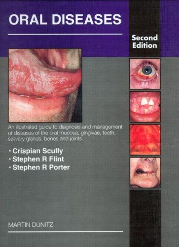 Salivary-Gland-Disorders