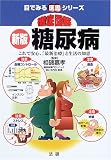徹底図解 新版 糖尿病―これで安心、「最新治療」と生活の知恵 (目で見る医書シリーズ)