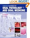 Cawson's Essentials of Oral Pathology and Oral Medicine