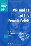 Review Springer  / MRI and CT of the Female Pelvis (Medical Radiology / Diagnostic Imaging)