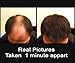 Samson Hair Building Fibers Hair Loss Concealer DARK BROWN XL REFILL 100gr Made in USA Available Worldwide