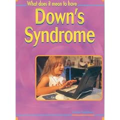 What Does it Mean to Have? Downs Syndrome Hardback (What does it mean to have / be ...?)