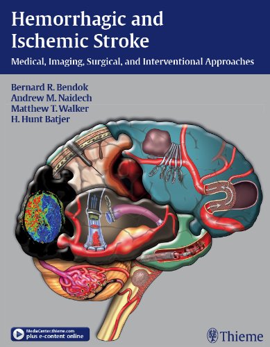 Hemorrhagic and Ischemic Stroke: Medical, Imaging, Surgical and Interventional  Approaches