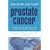 Prostate Cancer: Understand, Prevent and Overcome Prostrate Cancer