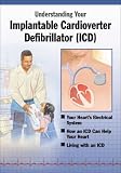 Implantable Cardioverter Defibrillator (ICD), Understanding Your