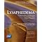 control your chronic lymphedema