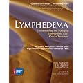 Lymphedema: Understanding and Managing Lymphedema After Cancer Treatment