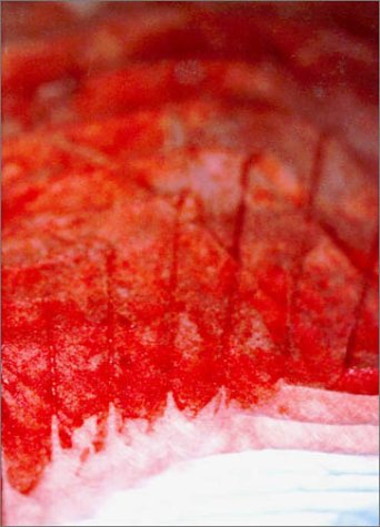 目のまえのつづき