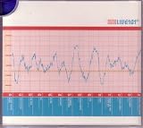 Q101 (Ultra Limed Rare Live and Acoutic Tracks)