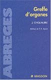 Greffe d'organes