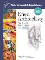 Knee Arthroplasty (Master Techniques in Orthopaedic Surgery)