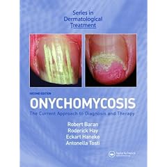 Onychomycosis, Second Edition (Series in Dermatological Treatment) by Robert Baran, Roderick J. Hay, Ekart Haneke and Antonella Tosti
