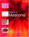 Textbook of Melanoma: Pathology, Diagnosis and Management