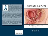 Prostate Cancer (WHAT YOU NEED TO KNOW)