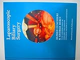 Laparoscopic biliary surgery