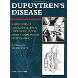 Dupuytren's Disease