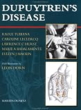 Books : Dupuytren's Disease