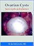 Ovarian Cysts A-Z: Facts, myths and solutions
