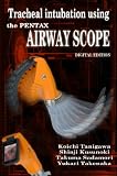 Tracheal intubation using the PENTAX Airway Scope