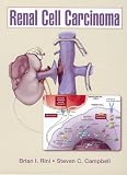 Renal cell carcinoma