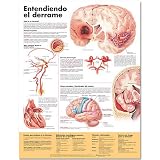 Understanding Stroke Anatomical Chart in Spanish (Entendiendo qué es un derrame)