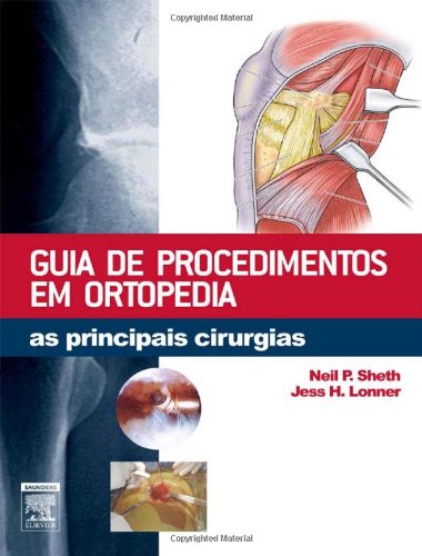 Guia de Procedimentos em Ortopedia. As Principais Cirurgias (Em Portuguese do Brasil)