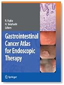 Gastrointestinal Cancer Atlas for Endoscopic Therapy
