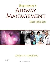 Benumof's Airway Management, 2e