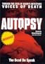 Autopsy