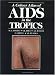 Book A Colour Atlas of AIDS in the Tropics (Wolfe Medical Atlases)