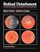 Books : Retinal Detachment: A Colour Manual of Diagnosis and Treatment (Colour Manuals in Ophthalmology)