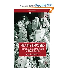 Hearts Exposed: Transplants and the Media in 1960s Britain