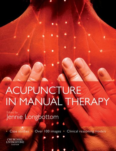 Acupuncture in Manual Therapy -