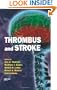 Thrombus and Stroke (Neurological Disease and Therapy)