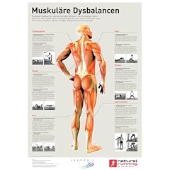 Muskul�re Dysbalancen: Muskul�re Defizite richtig erkennen und mit den optimalen �bungen behandeln