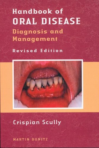 Handbook of Oral Disease