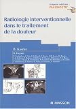 Radiologie interventionnelle dans le traitement de la douleur