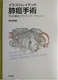 イラストレイテッド肺癌手術―手技の基本とアドバンスト・テクニックの商品情報を見る