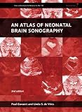 An atlas of neonatal brain sonography