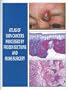 Atlas of Skin Cancers Processed by Frozen Sections and Mohs Surgery