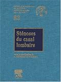 St�noses du canal lombaire