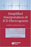 Simplified Interpretation of ICD Electrograms