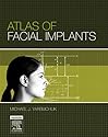 Atlas of Facial Implants