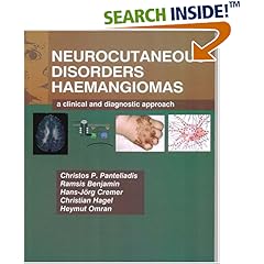 Neurocutaneous Disorders - Hemangiomas
