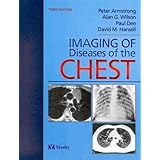 imaging of diseases of the chest