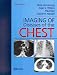 Books : Imaging of Diseases of the Chest
