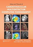 Atlas and Manual of Cardiovascular Multidetector Computed Tomography