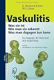 Vaskulitis: Was ist sie - Wie man sie erkennt - Was man dagegen tun kann - 